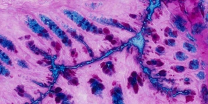 PAS-Alcian-Blue-scaled